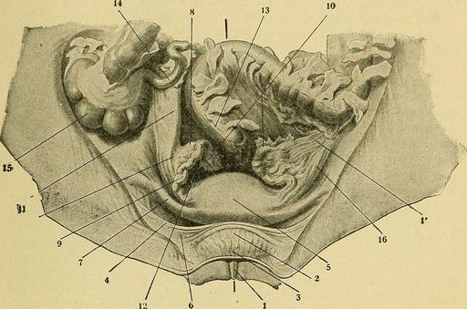 Pathology and treatment of diseases of women (1912) (14594959877 ...