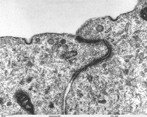 Junctional complex and pinocytotic vesicles - embryonic brain-TEM ...